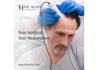  Non Surgical Hair Replacement For Men