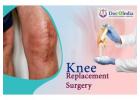 Knee Replacement: Choose DocplusIndia