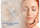 Best Burn Scars Treatment in Bangalore - Anew Cosmetic Clinic