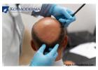 Growth Factor Treatment in Delhi | Advanced Alopecia Treatment at Kosmoderma