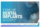 Bet Dental Implants in Gurgaon