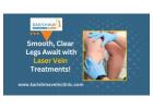 Laser treatment for varicose veins in Pune | Karishma Vein Clinic Pune