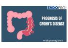 How Lifestyle Affects the Prognosis of Crohn's Disease