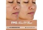 Effective Open Pores Treatment in Hyderabad | FMS Skin & Hair Clinic