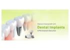 Best and Affordable Dental Implants in India