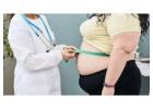 Experience Expert Care at the Best Obesity Clinic in Delhi: Myo Clinix