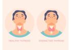 Homeopathic Medicine For Thyroid