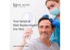 non surgical hair restoration