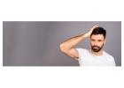 Best Hair Transplant in South Delhi - Soulderma Clinic