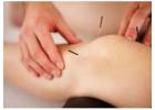 Dry needling near me