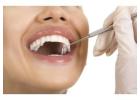 Best Clinic For Root Canal Treatment in Holland V