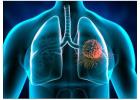 Pulmonary hospital in Delhi