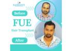 Radiance Advanced Hair Transplant Center