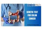 Exploring the Role of Genetic Testing in Colon Cancer Prevention