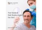 Non Surgical Hair Replacement For Men fresno