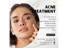 Get Acne Treatment in Greater Kailash at Soul Derma