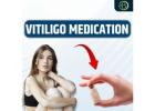 Vitiligo Treatment Naturally: Holistic & Effective Remedies for Skin Pigmentation