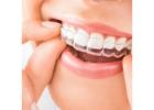 Transform Your Smile with Invisalign at Soda City Dentistry in Columbia SC