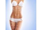 body contouring in Dubai Dr Juan