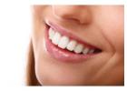 Transform Your Smile with Professional Teeth Whitening Services in Burton