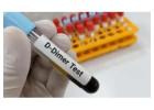 What is a D-dimer test? – A Complete Overview