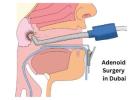 Adenoid surgery in Dubai | Dr Mustafa Kapadia