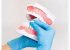 Get the Reliable Dental Implants Services in Red Deer by Delta Dental