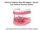 Denture Implants Near NE Calgary 