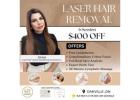 Laser Hair Removal Treatments