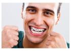 Orthodontic Treatment in Calgary | Straighten Your Smile with Expert Care