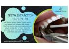 Affordable and Expert Teeth Extractions in Bristol, PA – Optima Dental Office