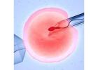 Affordable IVF Cost & Top IVF Center