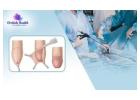 Transparent Circumcision Surgery Cost in Bangalore - Orchidz Health