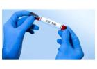 STD Test vs. HIV Test: A Comprehensive Guide