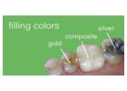 Dental Sealants - My Scottsdale Dentist