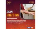 best burn treatment without skin grafting