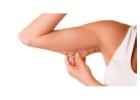 Arm Lift Surgery in Delhi - Dr Rajat Gupta