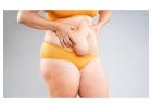 How Painful is a Tummy Tuck? 