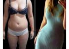 Transform Your Post-Pregnancy Body with the Mommy Makeover at Divine Cosmetic