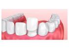 Best Dental Clinic in Coimbatore With Top Dental Treatments