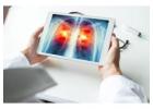 Lung Cancer doctor in Gurgaon