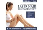 Best Laser Hair Reduction for Silky Smooth Skin