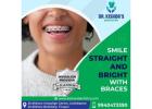 Achieve Perfect Teeth Alignment with Invisalign in Kilpauk, Chennai