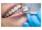  Professional Teeth Whitening in Preston | Achieve a Brighter Smile