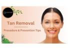 Sun-Kissed No More: Tan Reversal Regimen