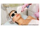 Skintastic is best for Laser Hair Removal in Riverside 