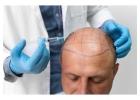 Trusted Hair Doctor in Fort Lauderdale – Restore Your Confidence at Powell Medical Center!