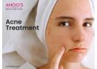 Advanced Acne removal treatment at Anoos