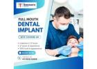 Restore Your Confidence with Full Mouth Implants – Top Dentist in Bangalore