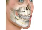 Best Jaw surgery treatment in Dubai UAE